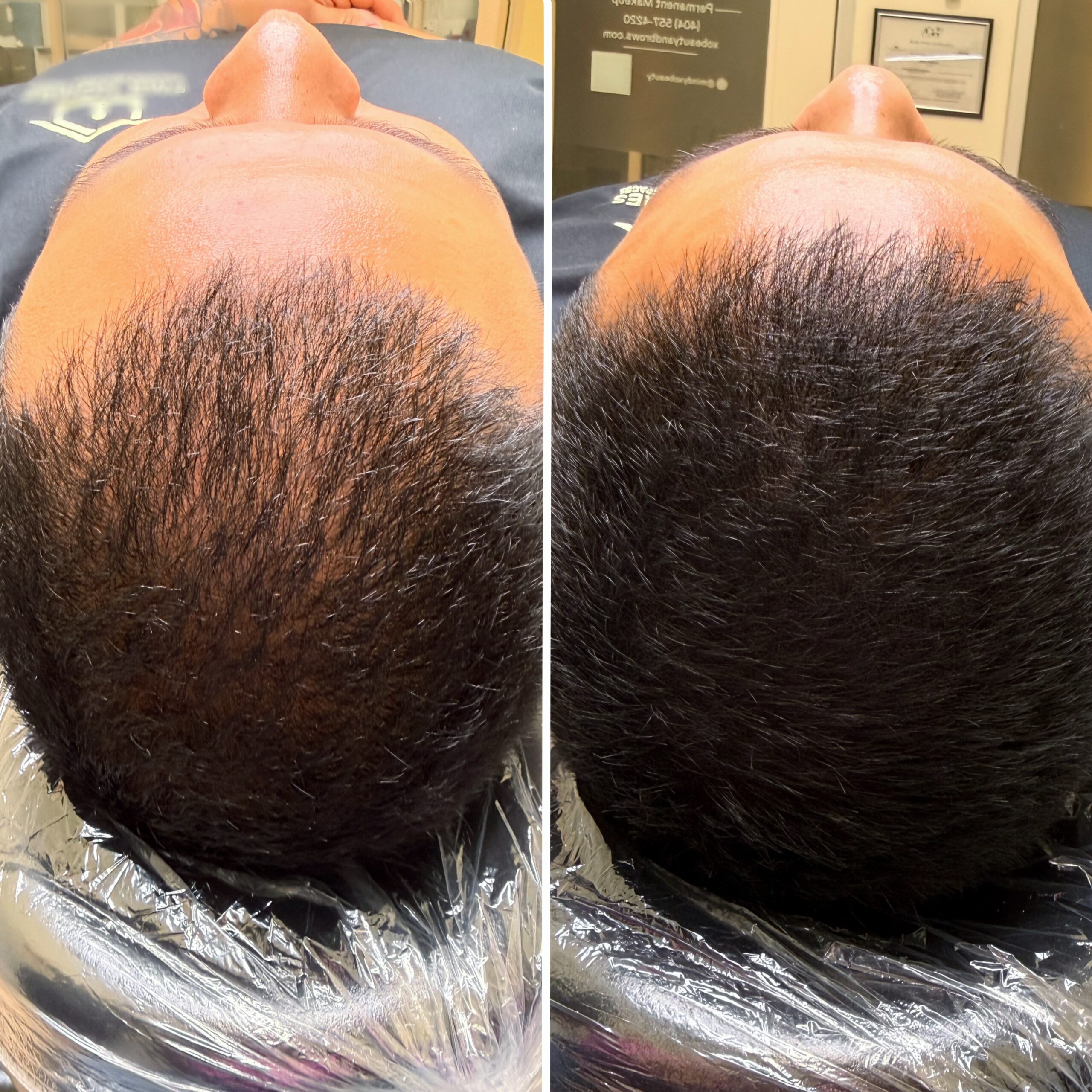 NEW Hair Fiber Tattoo for Thinning Hair